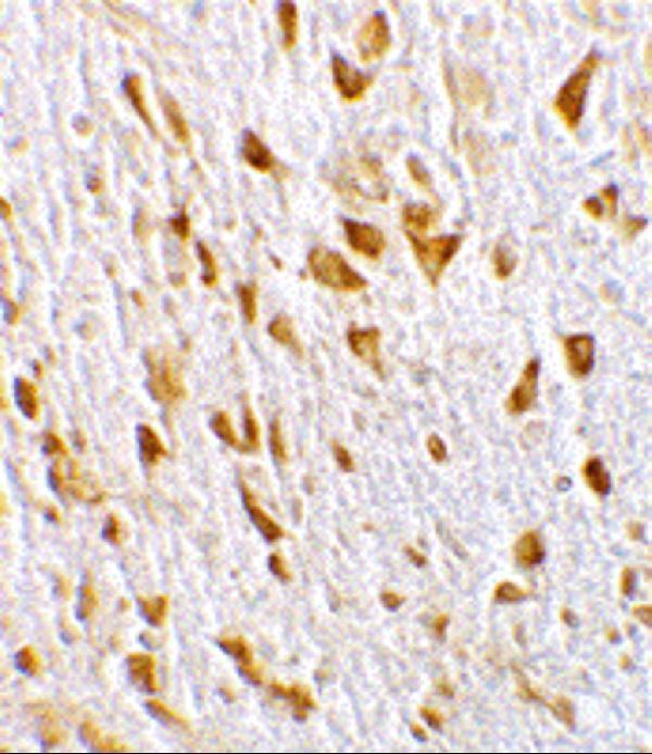 a04771 1 agap2 primary antibodies ihc testing 2