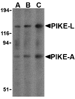 a04771 1 agap2 primary antibodies wb testing 1