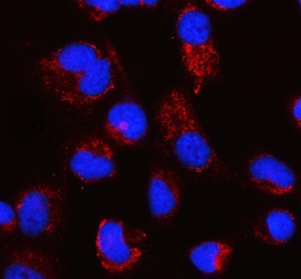 a04772 1 pck2 primary antibodies if testing 1