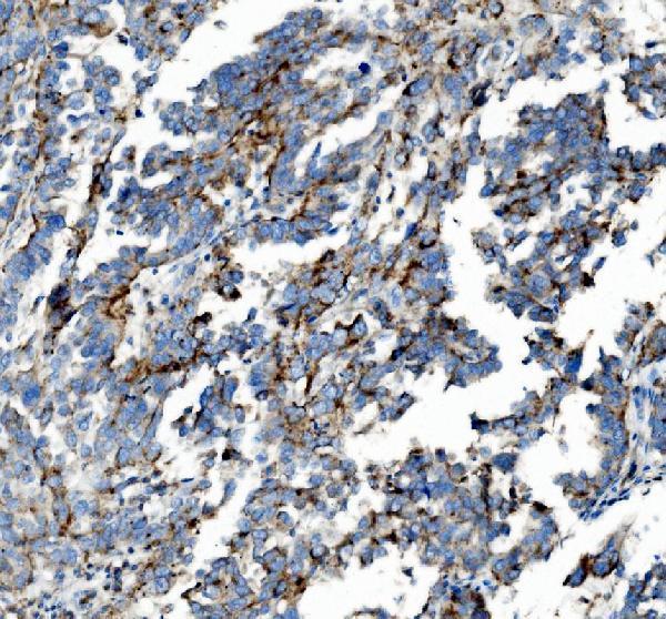 a04772 1 pck2 primary antibodies ihc testing 1