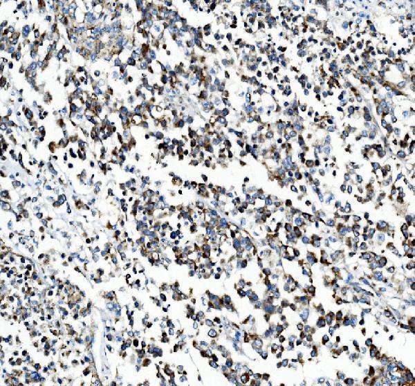 a04772 1 pck2 primary antibodies ihc testing 2_1