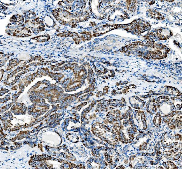 a04772 1 pck2 primary antibodies ihc testing 3_1