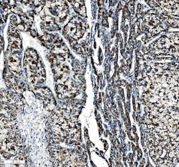 a04772 1 pck2 primary antibodies ihc testing 4_1