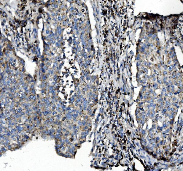 a04772 1 pck2 primary antibodies ihc testing 5_1