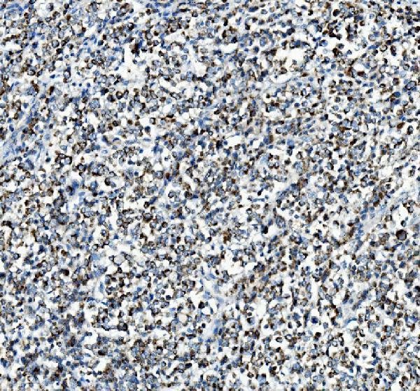 a04772 1 pck2 primary antibodies ihc testing 6_1