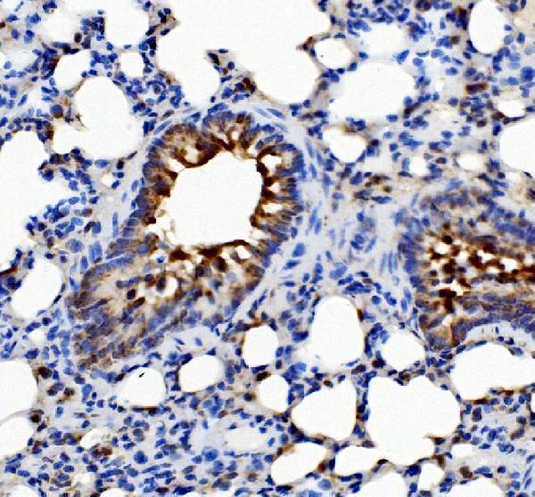 a04772 1 pck2 primary antibodies ihc testing 8