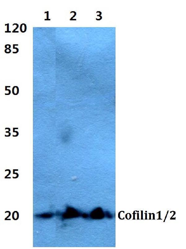 a04773t88 cfl2 primary antiboties wb testing 1