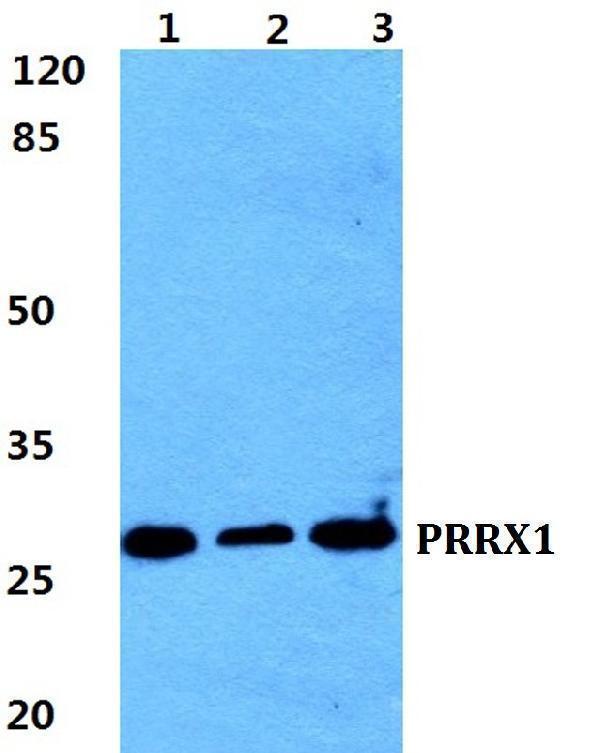 Western blot (WB) analysis of PRRX1 polyclonal antibody at 1:500 dilution
Lane1:HEK293T cell lysate
Lane2:Raw264