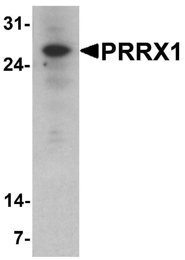 Western blot analysis of PRRX1 in HeLa cell lysate with PRRX1 antibody at 1 μg/ml