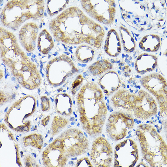 Immunohistochemistry of paraffin-embedded rat kidney using CC2D1A Rabbit pAb  at dilution of 1:200 