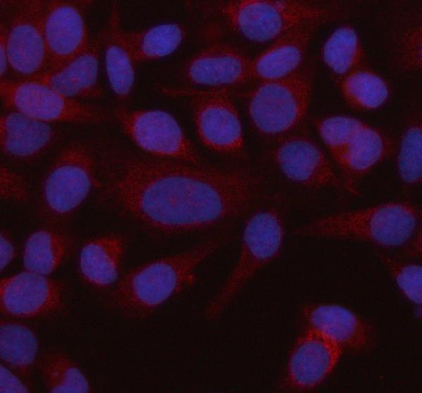 a04776 2 hadhb primary antibodies if testing 12