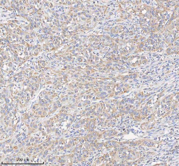 a04776 2 hadhb primary antibodies ihc testing 10