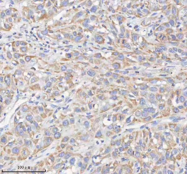 a04776 2 hadhb primary antibodies ihc testing 11