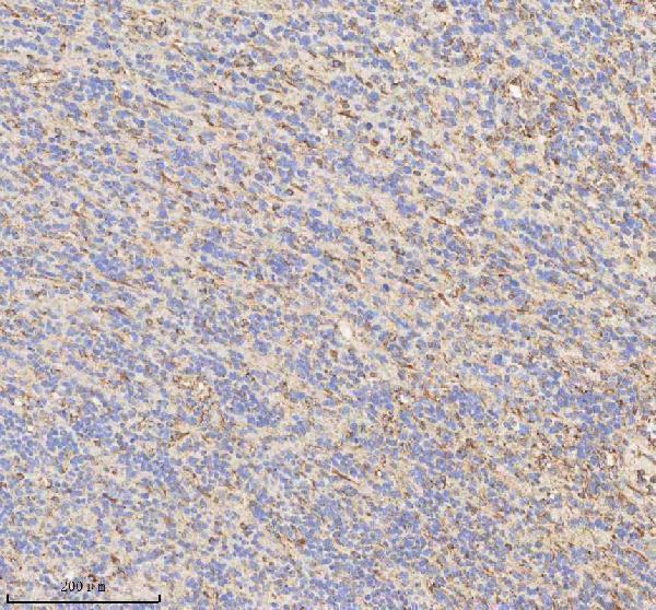  IHC analysis of HADHB using anti-HADHB antibody (A04776-2)