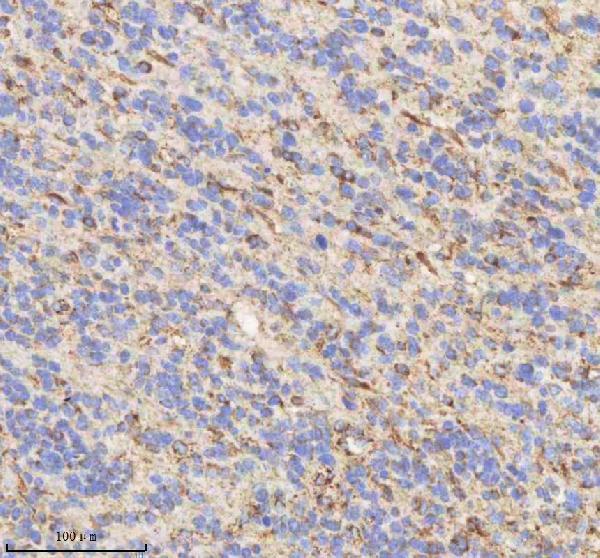  IHC analysis of HADHB using anti-HADHB antibody (A04776-2)