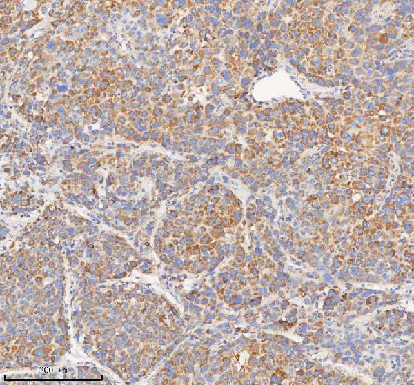 a04776 2 hadhb primary antibodies ihc testing 4