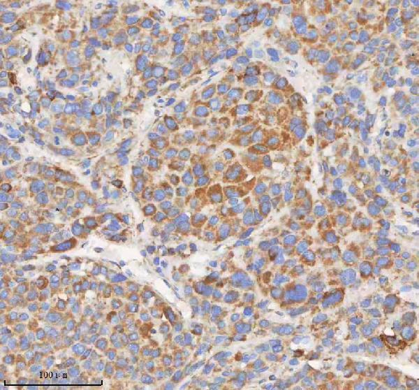 a04776 2 hadhb primary antibodies ihc testing 5