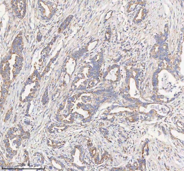 a04776 2 hadhb primary antibodies ihc testing 6