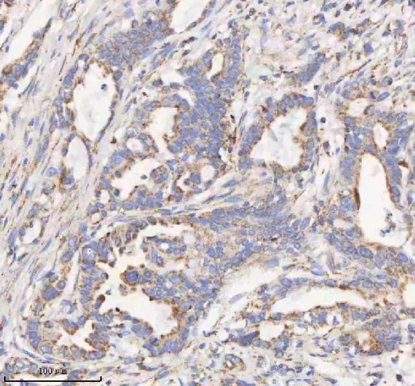 a04776 2 hadhb primary antibodies ihc testing 7