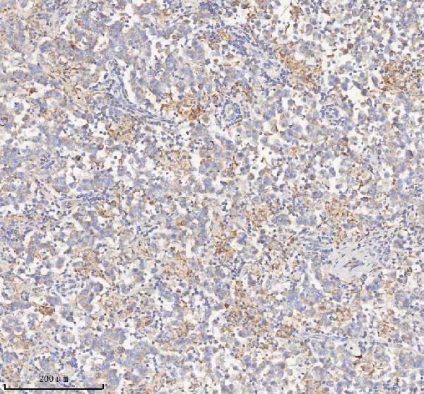 a04776 2 hadhb primary antibodies ihc testing 8