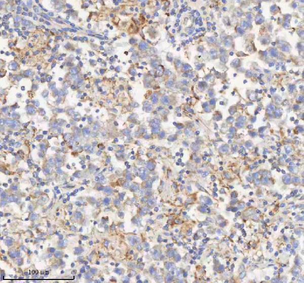 a04776 2 hadhb primary antibodies ihc testing 9