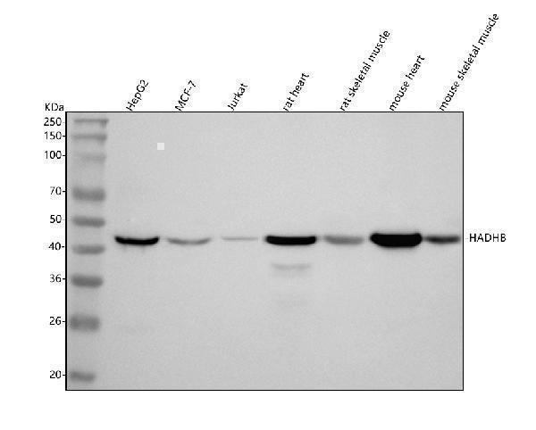  Western blot analysis of HADHB using anti-HADHB antibody (A04776-2)