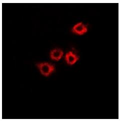a04776 hadhb primary antiboties if testing 2