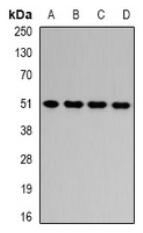 a04776 hadhb primary antiboties wb testing 1