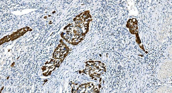  IHC analysis of Glycine decarboxylase/GLDC using anti-Glycine decarboxylase/GLDC antibody (A04777-2)