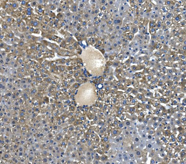 a04777 2 gldc primary antibodies ihc testing 4