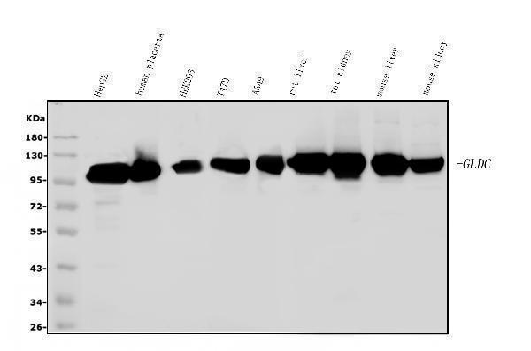  Western blot analysis of Glycine decarboxylase/GLDC using anti-Glycine decarboxylase/GLDC antibody (A04777-2)