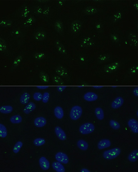 Immunofluorescence analysis of U-2 OS cells using NOLC1 antibody  at dilution of 1:100