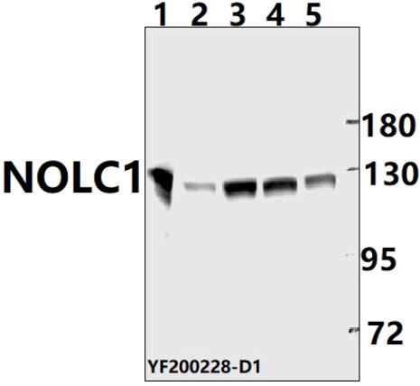 Western blot (WB) analysis of NOLC1 pAb at 1:500 dilution
Lane1:CT-26 whole cell lysate(40ug)
Lane2:C6 whole cell lysate(40ug) 
Lane3:A549 whole cell lysate(40ug)
Lane4:Panc1  whole cell lysate(40ug)
Lane5:SGC7901 whole cell lysate (40ug)  