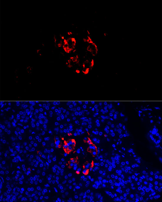 Immunofluorescence analysis of human pancreas cells using SCG2 Rabbit pAb  at dilution of 1:100 