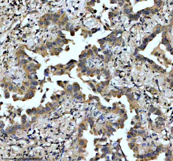 IHC analysis of EFTUD2 using anti-EFTUD2 antibody (A04780-2)