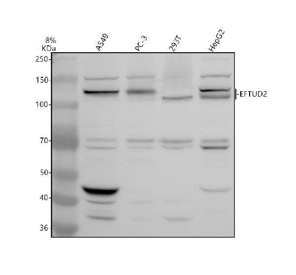 Western blot analysis of EFTUD2 using anti-EFTUD2 antibody (A04780-2)