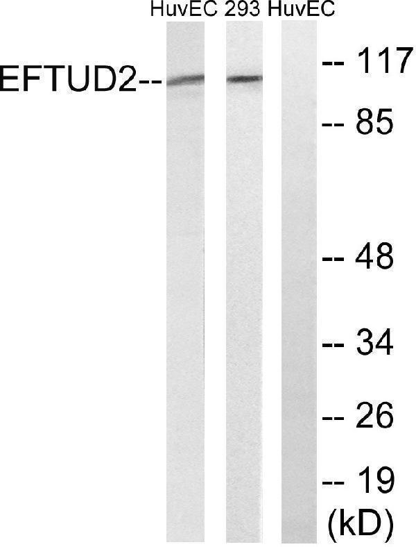 Western blot analysis of lysates from 293 and HUVEC cells, using EFTUD2 Antibody
