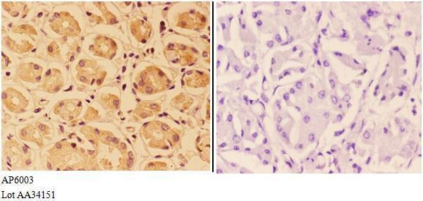 a04781 ptpro primary antiboties ihc testing 3