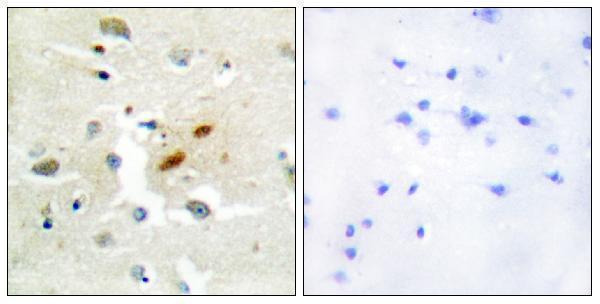 Immunohistochemistry analysis of paraffin-embedded human brain tissue, using DNA Polymerase zeta Antibody