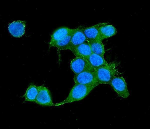 a04787 1 iqgap2 primary antibodies if testing 5