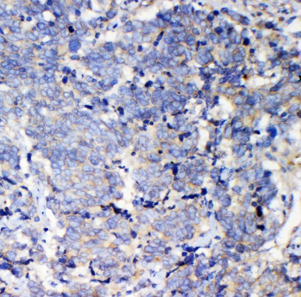 a04787 1 iqgap2 primary antibodies ihc testing 3