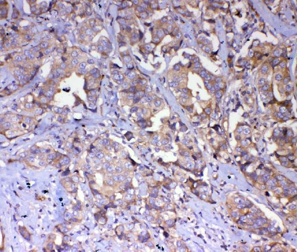 a04787 1 iqgap2 primary antibodies ihc testing 4