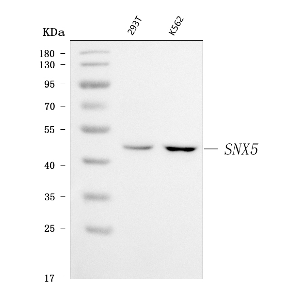  Western blot analysis of SNX5 using anti-SNX5 antibody (A04788-1)