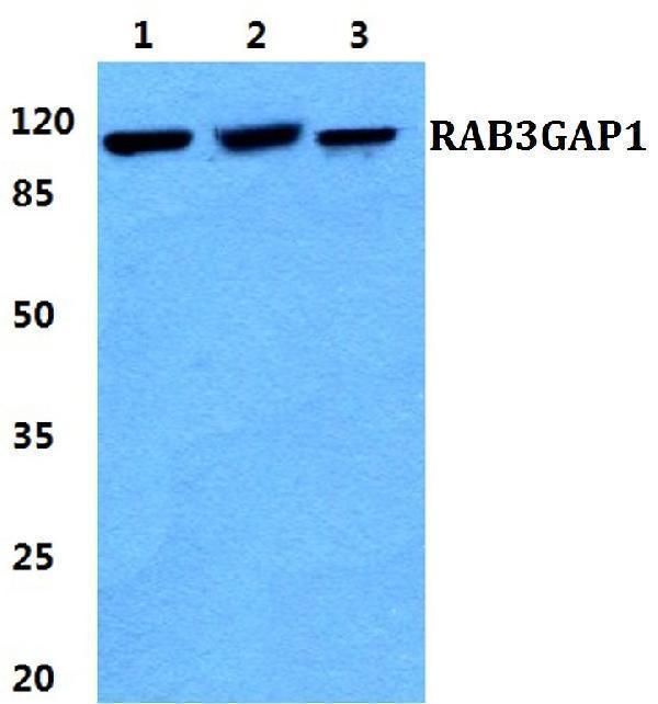 a04789 1 rab3gap1 primary antiboties wb testing 1