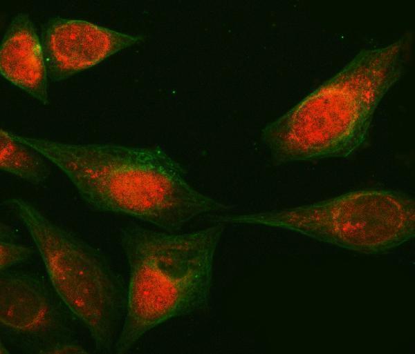a04789 2 rab3gap1 primary antibodies if testing 10_2