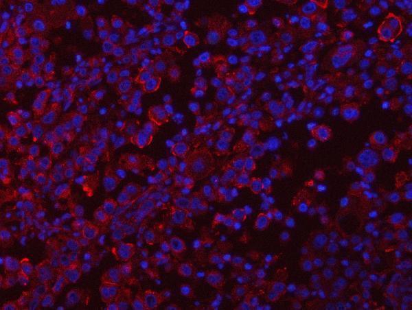a04789 2 rab3gap1 primary antibodies if testing 8