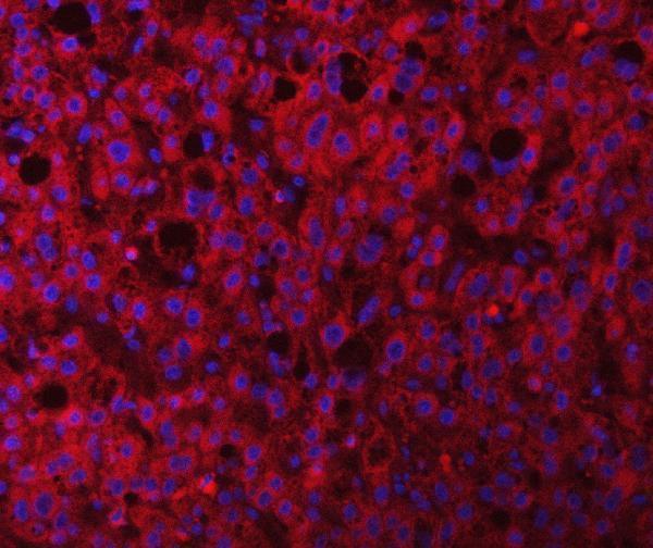 a04789 2 rab3gap1 primary antibodies if testing 9