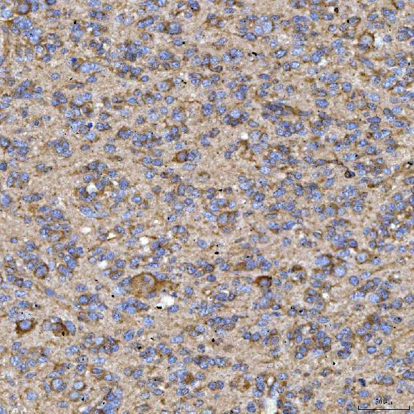 a04789 2 rab3gap1 primary antibodies ihc testing 2