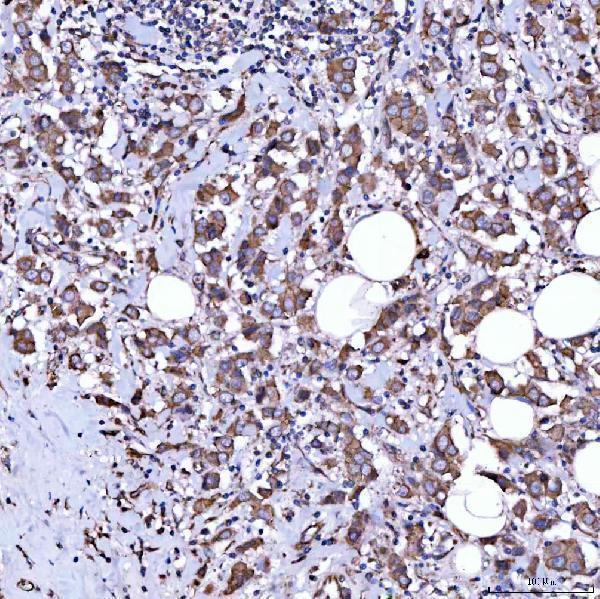 a04789 2 rab3gap1 primary antibodies ihc testing 3