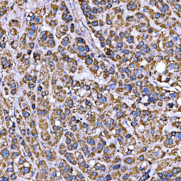 a04789 2 rab3gap1 primary antibodies ihc testing 4